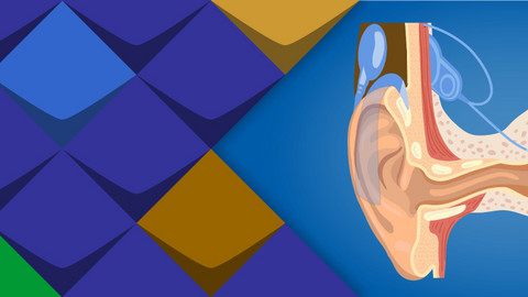 Eine Schemazeichnung eines implantierten Cochlea-Implantats