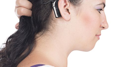 Das Cochlea-Implantat