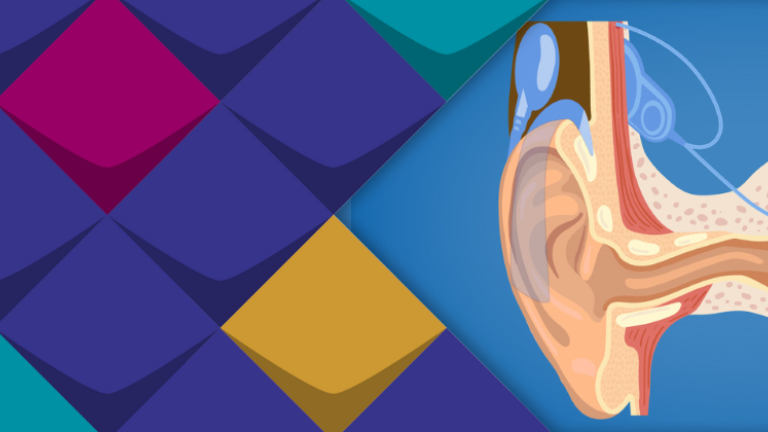 Das Bild zeigt das Modell eines Ohres mit Cochlea Implantat.